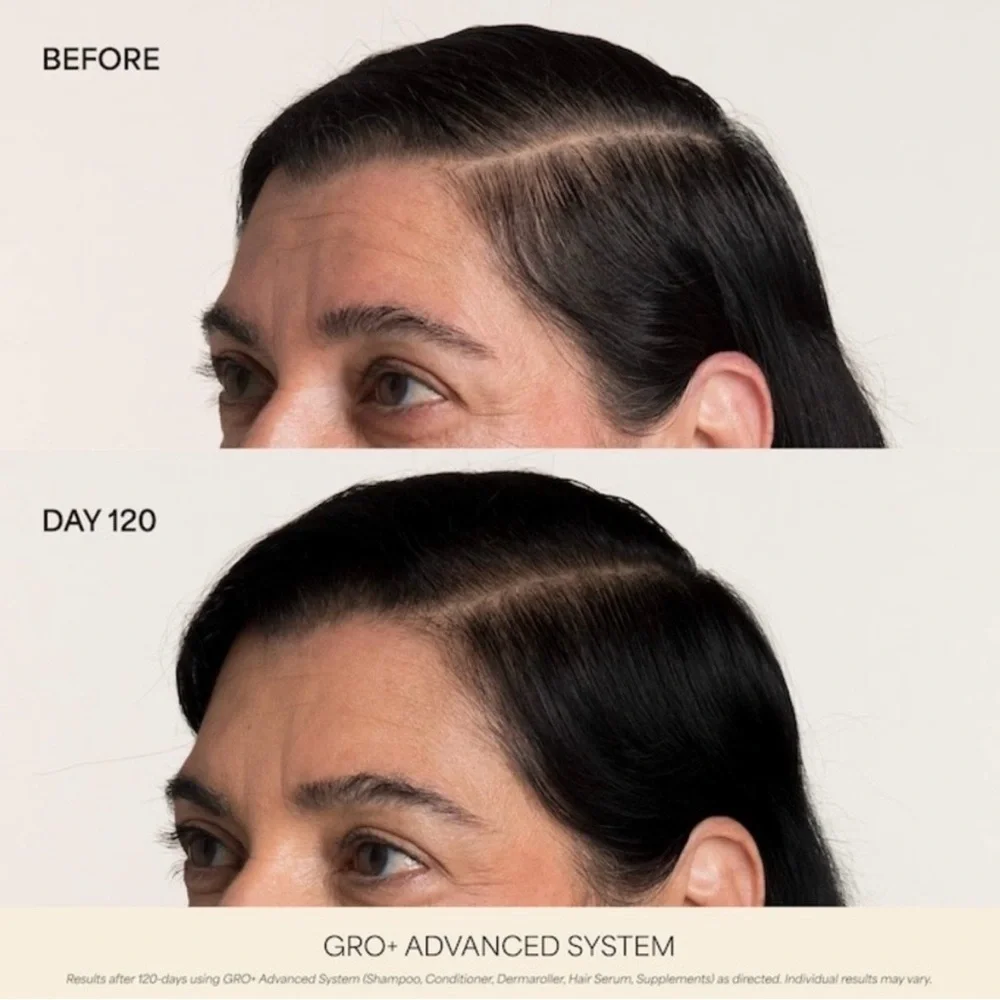 🎸Vegamour🎸🔥NWT🔥GRO+ Advanced Hair Serum for Severe Signs of Thinning-1 Fl oz.